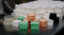Image de DENTELLES STEAK ROND NOIR (1000pcs)
